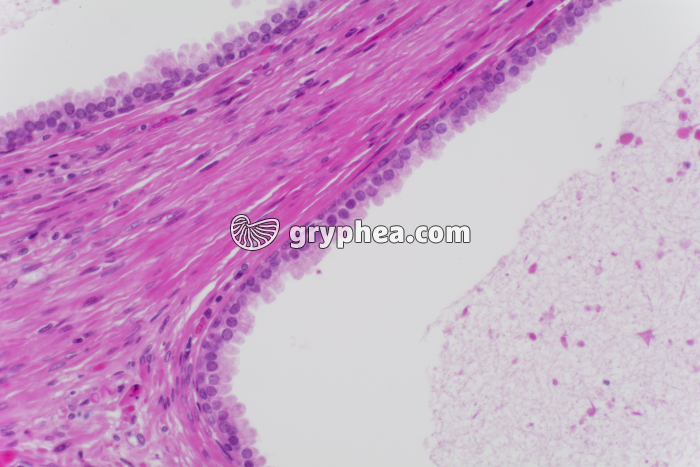 Prostate x100 - gryphea.com